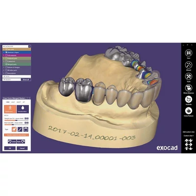 Exocad Implant Lab Bundle tervezőszoftver